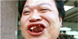 구강암 환자 90%가 섭취한 충격의 열매, 중국 광고금지