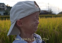 20살이 최대 수명…‘조로증’ 원기 “우리, 오늘을 살아요”
