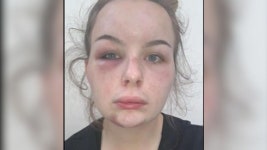 “좋은 쪽은 입 다물고, 나쁜 쪽이 마을을” 英 여성 거짓말에 쑥대밭