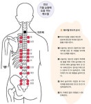 명절증후군 한방요법으로 한 방에 날려 버려~