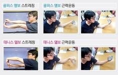 [지긋지긋한 팔꿈치 통증] 나 좀 적당히 써! 팔꿈치의 비명