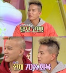 안녕하세요 프니엘, 탈모 고백 이후 근황 공개 현재 70% 정도 회복