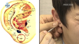이경제 한의원 방문한 기안84, 진찰받은 귀 혈자리 어떻게 생겼을까?