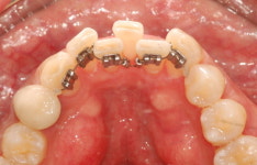 처음보다 더 신중해야 하는 ‘재교정’