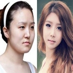 렛미인3 방미선, 무려 22kg 감량 후 “개미허리의 베이글녀 재탄생”