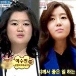 이용식 딸 이수민 아빠 닮았단 말에 상처…결국 눈, 코 성형