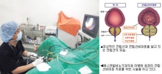 [의료특집] 예스연합비뇨기과의원-전립선