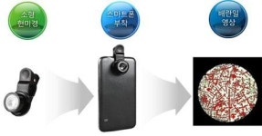스마트 배란측정기 첫 개발 대구 첨복재단·종로의료기 공동