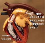 심장사상충 예방약이 독이 된 사연 [박순석의 동물병원 24시]