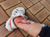 목줄 매세요 애원에도 우리 개는 안 물어요…대구 도심공원 곳곳 오프리쉬