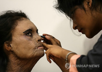 패션쇼를 준비하는 염산 테러 생존자
