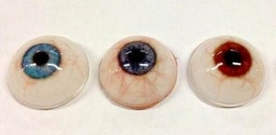 3D프린터로 의안까지 만들었다