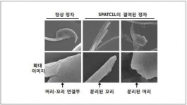 정자 머리-꼬리 연결하는 단백질 활동 밝혔다