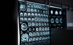 [미래의료] 120년만에 흑백 2D 의료영상을 3D 입체컬러로 바꾼 스타트업