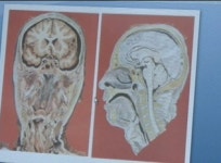 [건강] 이유없이 여기저기 쑤시고 아픈데…혹시?