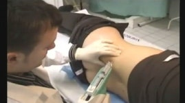 원하는 부위에 맞으면 살이 쏙?…PPC 시술 자제