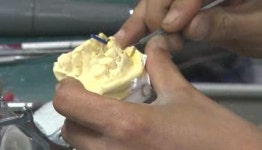 치기공사 노인 틀니 제작 거부…비용 따로 책정