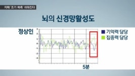 [취재파일] 치매, 초기에 잡는다