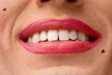 [리빙] 인상 좌우하는 점…왜 생기는 걸까?