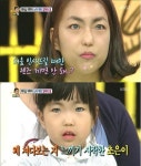 ‘안녕하세요’ 파란눈 모녀 “장애나 질병이 아니다”