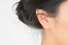 [건강] 귀 콤플렉스, 모양 따라 적합한 시술 적용해야