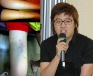 김미리내, 이상구에 폭행당한 사진 공개