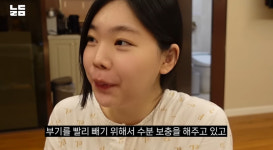 이다은 스킨&바디 | "부기 장난 아니죠?" 이다은, 둘째 낳고 살 더 쪘네..어떤 모습?