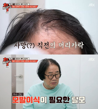 최양락, 쌍꺼풀→리프팅 성형 다 했는데 모발 이식 거부..