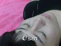 한의원 자주 찾는 여자 연예인들, 무슨 이유?