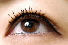 쌍꺼풀 수술이 자연스럽지 못하면 재수술 고려해야 ..