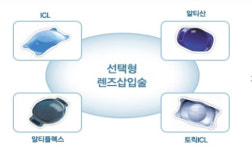 시력이 나빠 라식도 안된다면... 렌즈를 눈안에 넣어보자!