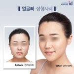 사각턱! 득(得) 되는 정보, 해(害) 되는 정보 정확히 알아야
