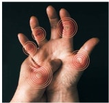 자가면역질환 류마티스 관절염, 치료는 어떻게 해야할까