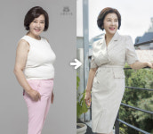 66세 김영란, 6주 만에 6kg 다이어트 성형했냐 물어봐