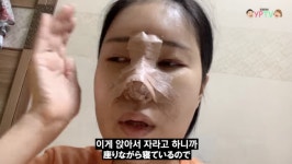 이세영 코 성형 지옥, 생각보다 빡세…코뼈 절골 심각한 붓기[종합]