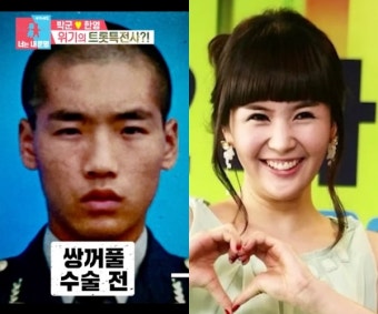 쌍커풀 3번→코 2번..박군·장영란, 수술 전 얼굴도 공개한 ‘성형 고수’[Oh!쎈 이슈]