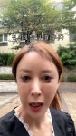 슈, 마스카라 범벅 오열 후 멍투성이 팔..S.E.S 또 걱정하겠네