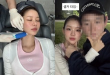맹승지, 직접 얼굴 시술해주는 의사 남친 자랑 