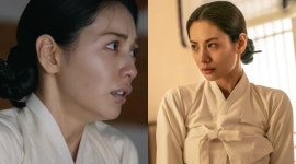 나나, '스캔들' 입술 필러 논란 입열었다..