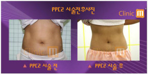 PPC보다 더 좋은 PPC = 맞춤형 PPC2 인기몰이