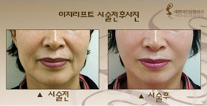 “어쩜 그렇게 안 늙어?” 거꾸로 늙어가는 중년들의 비결이란?