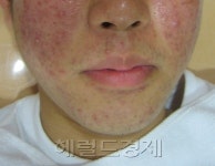 남성이 상대의 얼굴 볼때 여성은 피부봐요