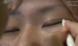 “한국 여성들은 쌍꺼풀 수술 중독”