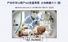 中 산모，7개월만에 0.98kg 초미숙아 조산!