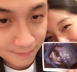 곧 있으면 엄마 돼요…김빈우, 임신 16주차 초음파 사진 공개