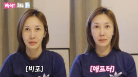 윤혜진, ♥엄태웅도 효과 본 경락 마사지…전후가 이렇게 다르네 [마데핫리뷰]