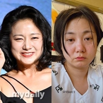 '은퇴고민' 박나래, 결국 3번째 성대수술→'나혼산' 녹화 불참 [MD이슈](종합)