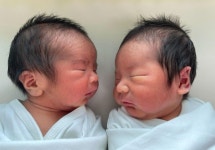 10만분의 1 확률 뚫고 겹쌍둥이 출산했는데...산모 출산 직후 하반신 마비