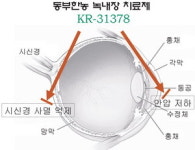 동부한농, 녹내장 치료제 기술 수출