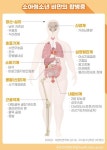 소아·청소년 비만, 올바른 체중 관리법은?